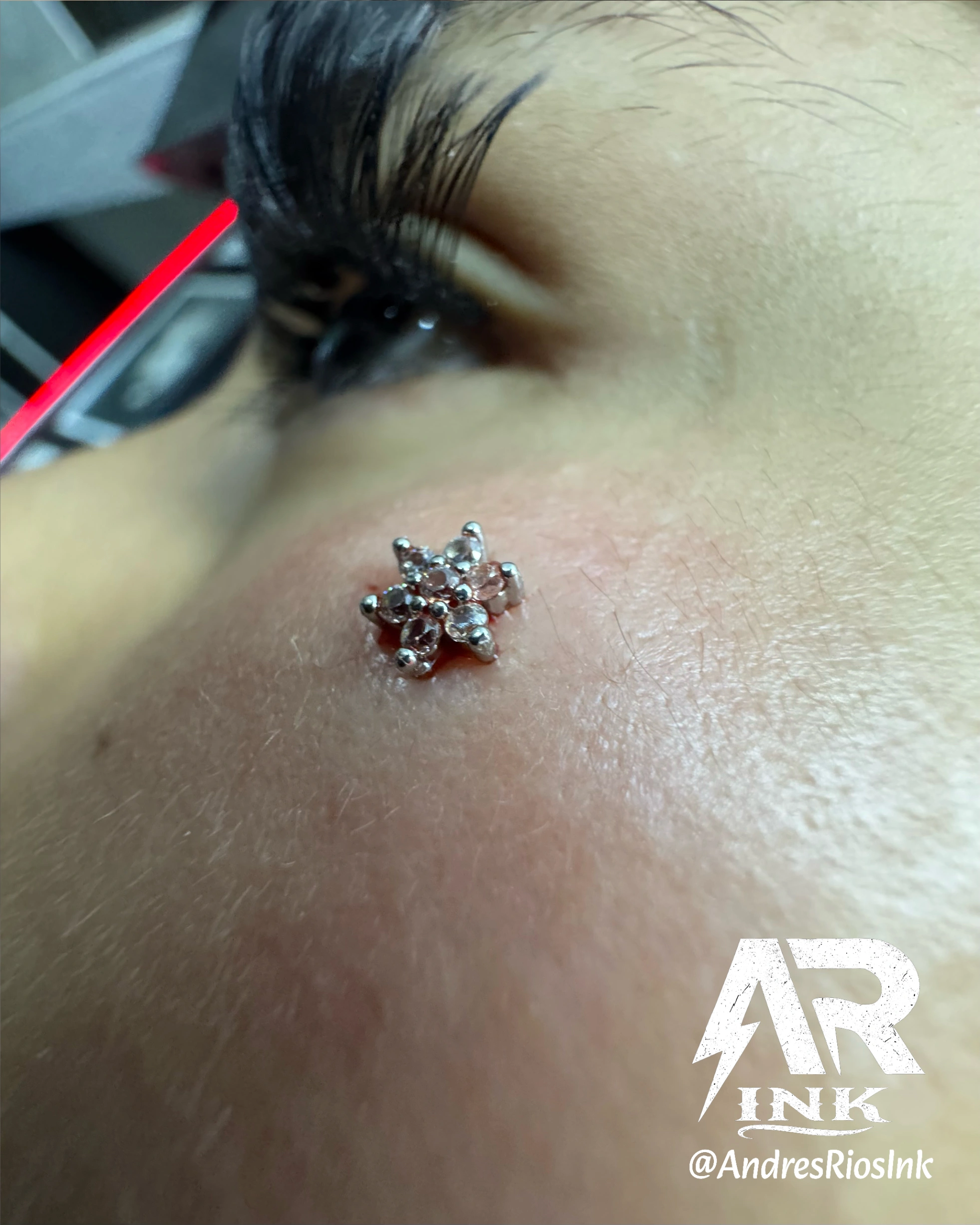implante-microdermal-flor