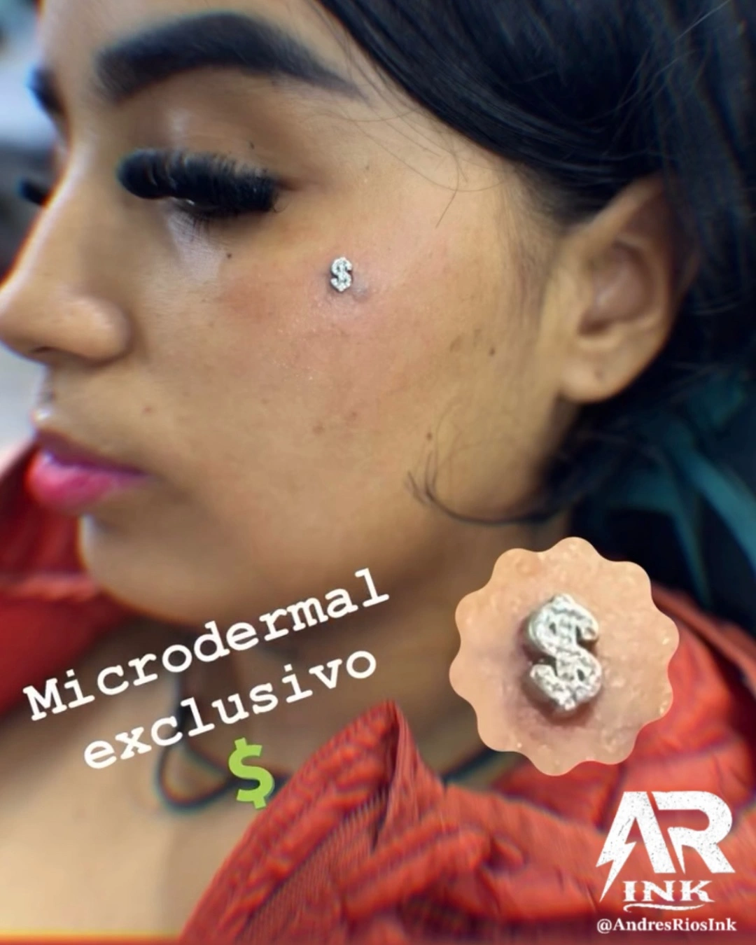 implante-microdermal-signo-dolar