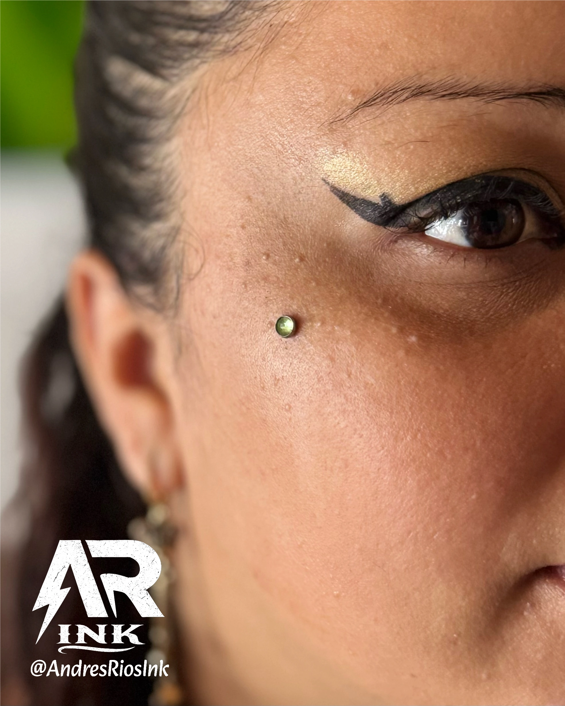 implante-microdermal-top-basico